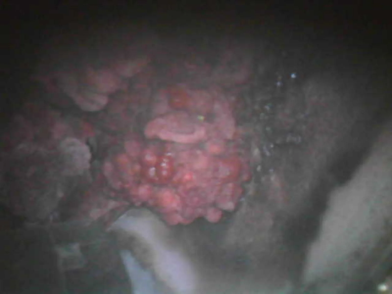20211204142106.webp