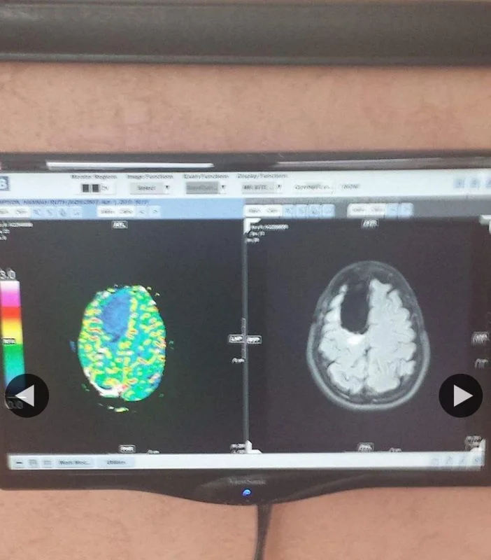 mri2.webp