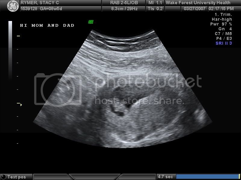 BABY8WK_3.jpg